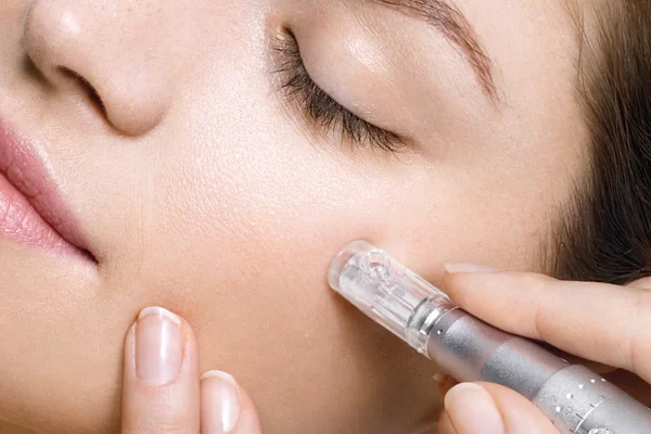 Micro Needling
